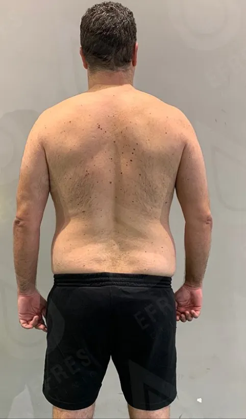 Похудение до-после6