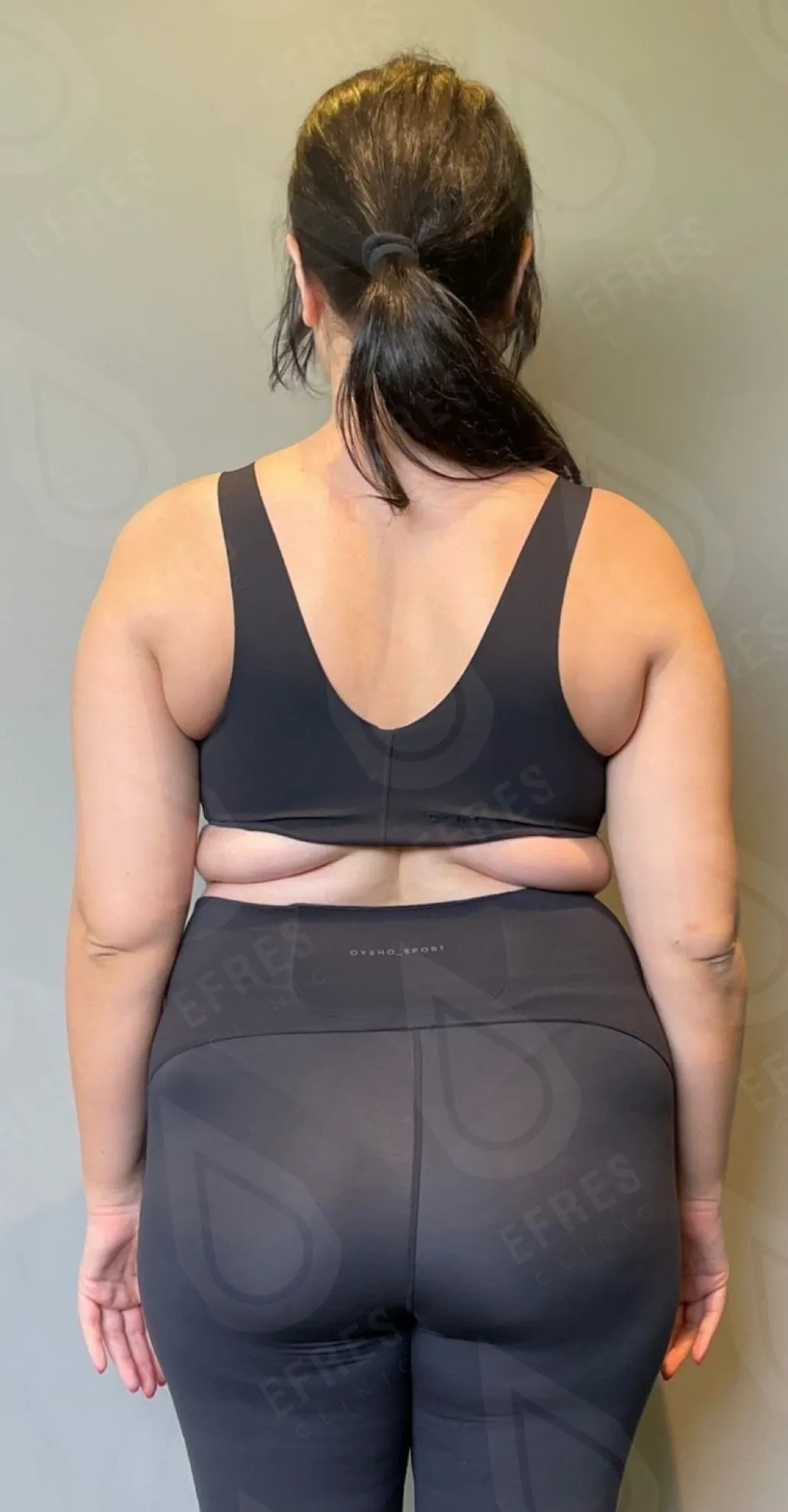 Похудение до-после6