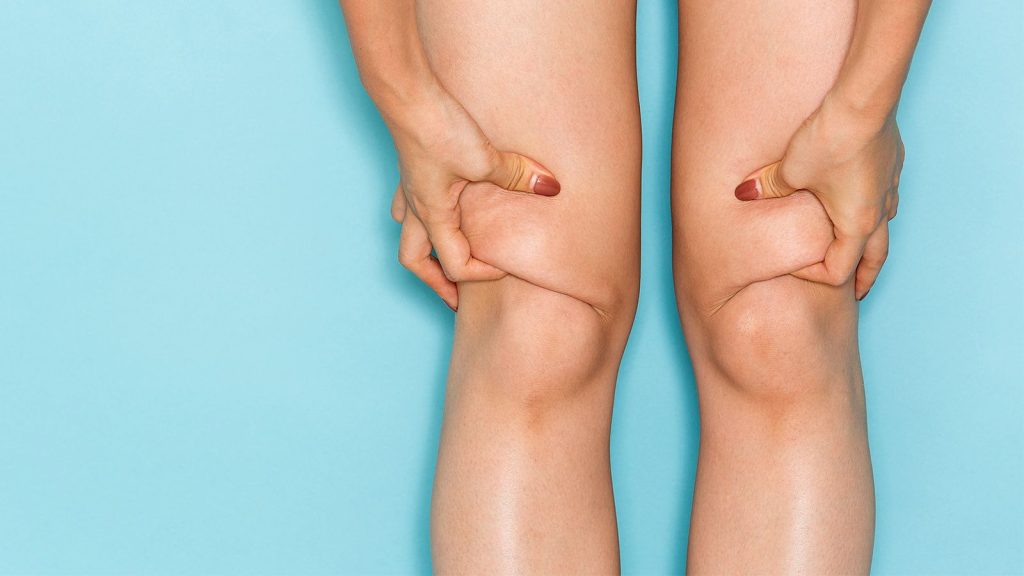 original-2-1024x576 (1).jpg как сделать худые колени