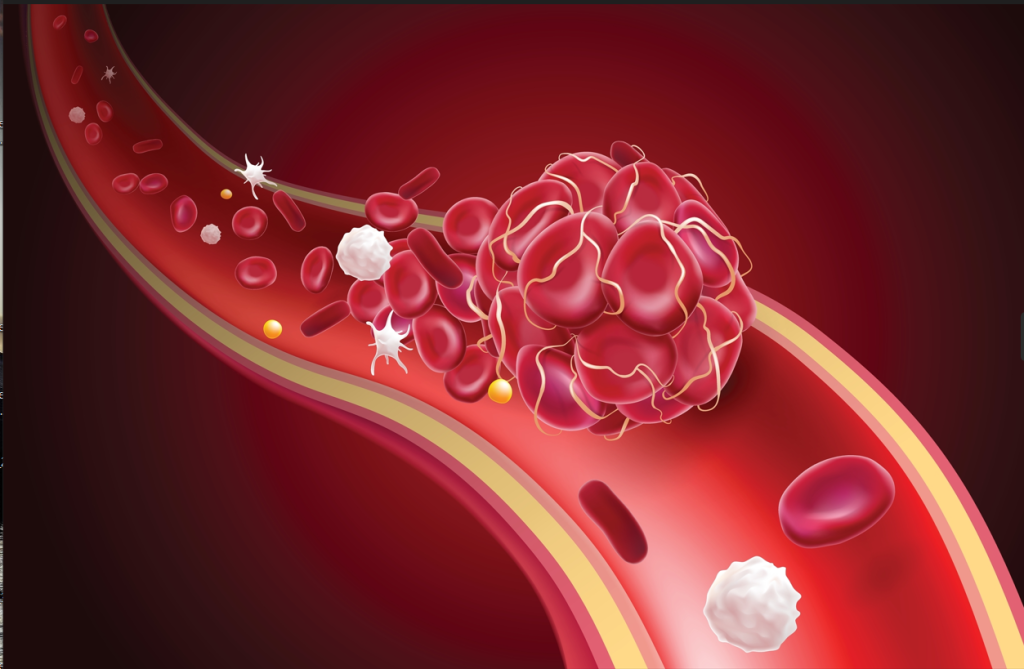 2_2852 (1).png как укрепить сосуды