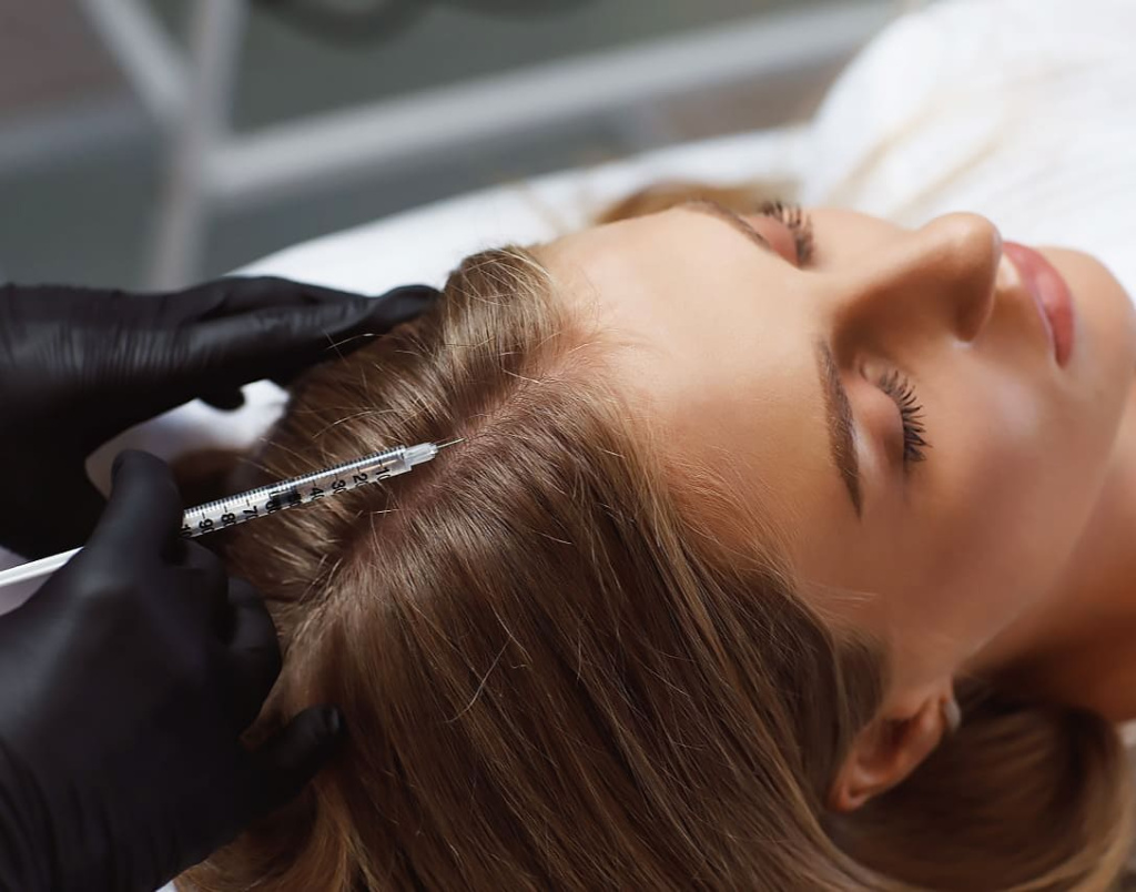 mezoterapiya-kozhi-golovy-pri-alopeczii.jpg mezoterapiya-kozhi-golovy-pri-alopeczii.jpg