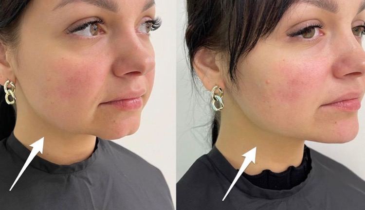 photo_2024-01-27_23-48-13.jpg photo_2024-01-27_23-48-13.jpg