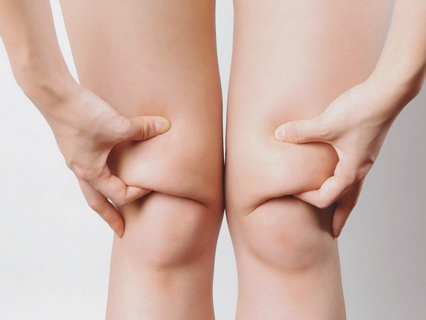 scale_1200-5.png как убрать жир с коленей