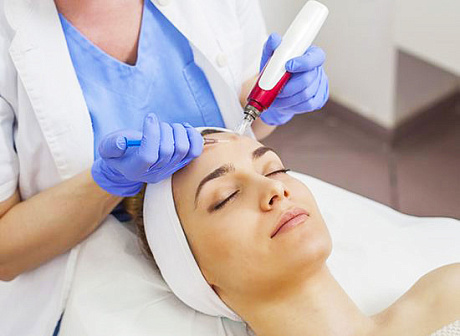 Фракционная мезотерапия для лица: что это такое